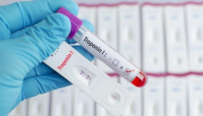 10.6.17.troponin.high sensitivity troponin tests still useful in patients with renal dysfunction and suspected acs, with caveats