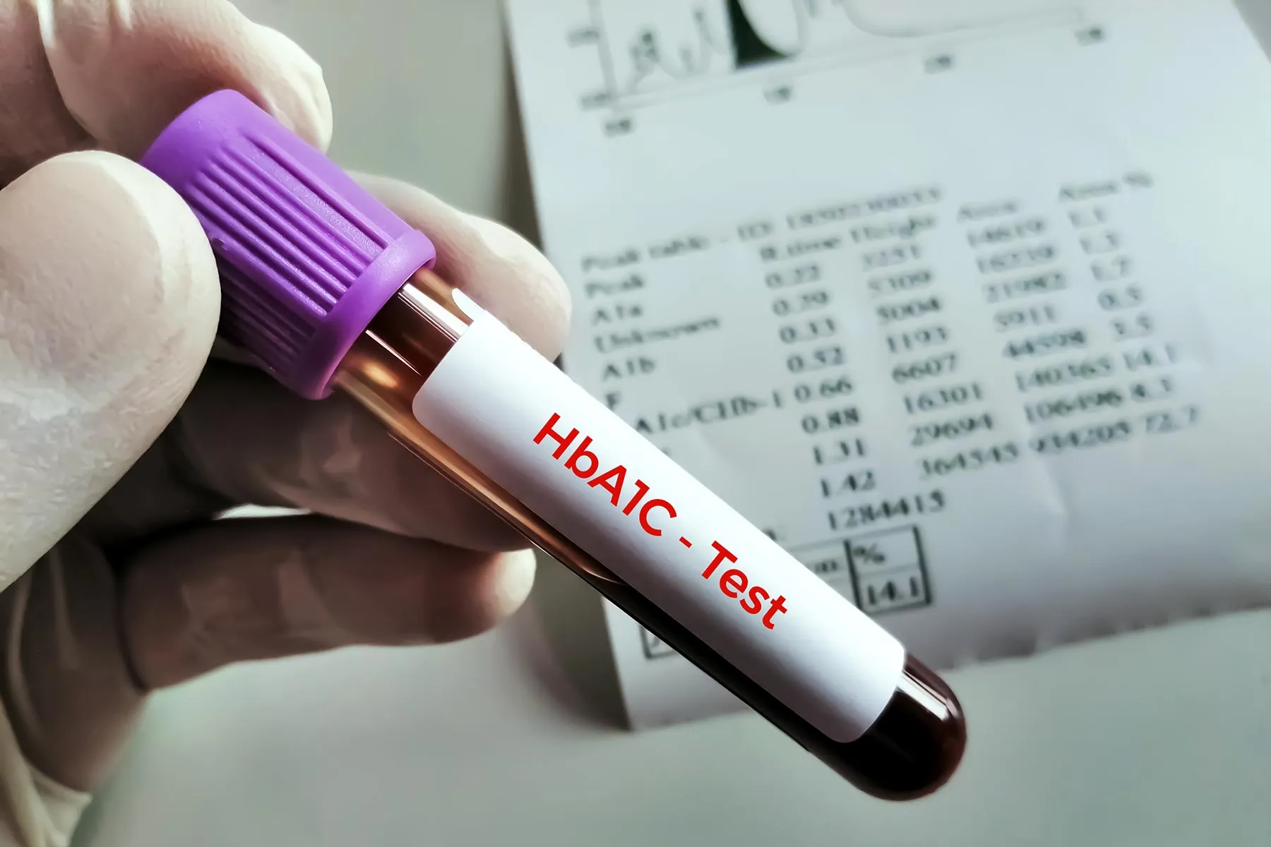 1800x1200 hba1c blood test bigbead
