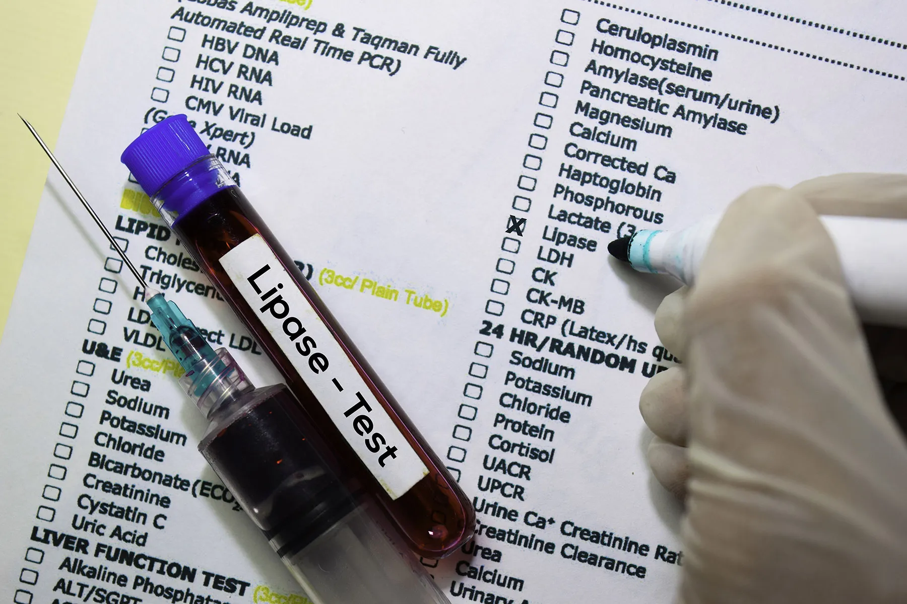 1800x1200 lipase test bigbead