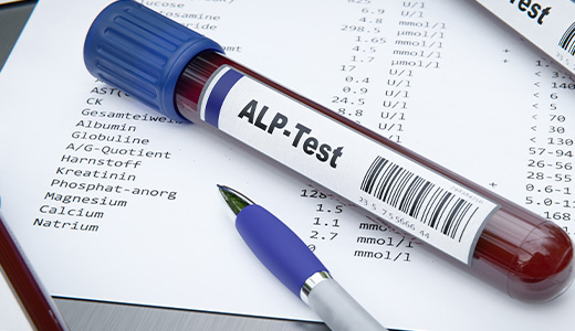 202306301514alptest