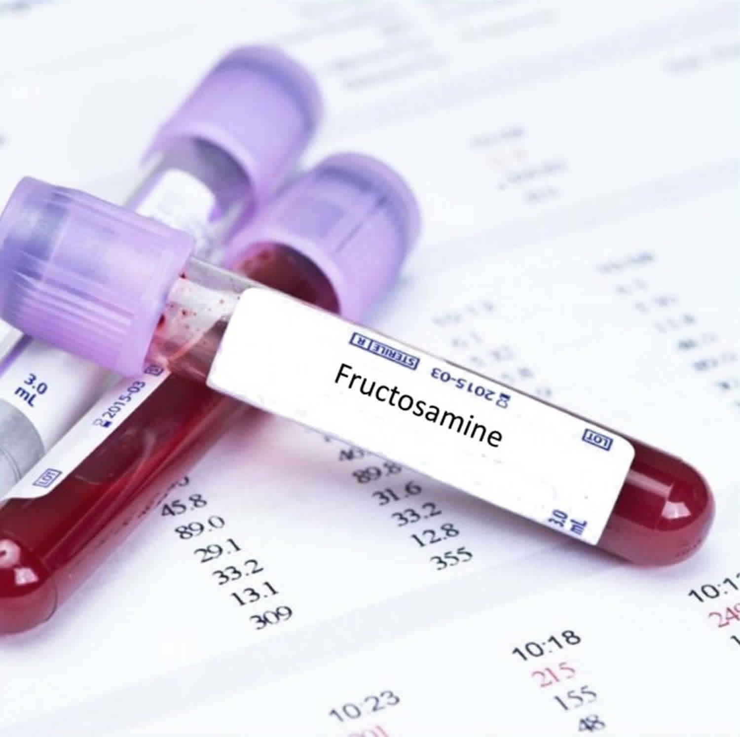219236 fructosamine