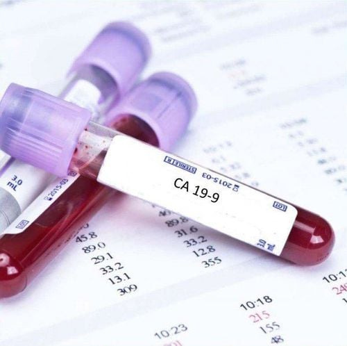 ca 19.9 test karauli diagnostics