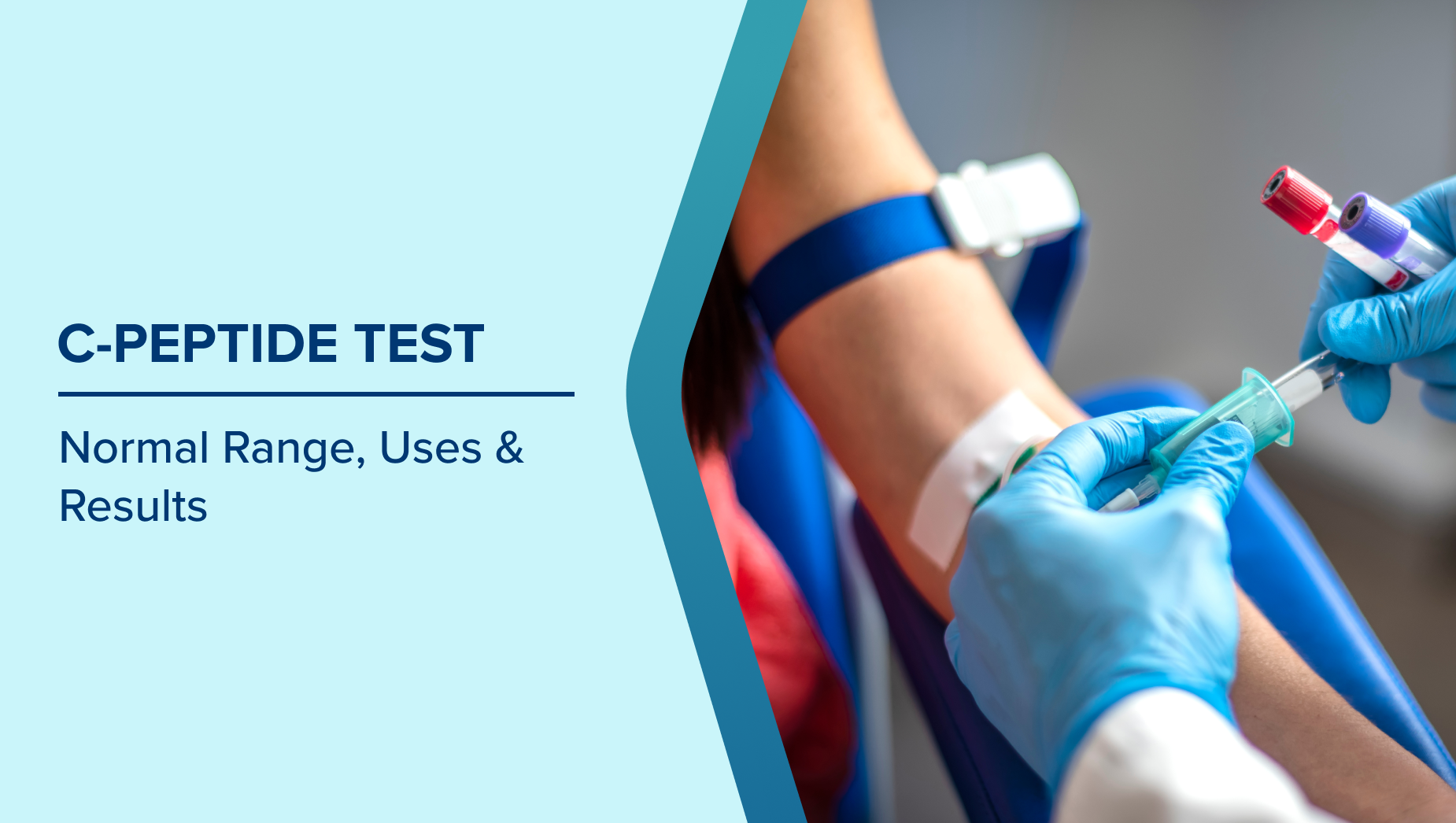 c peptide test d67e8f0782
