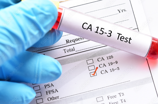 cancer antigen 15.3
