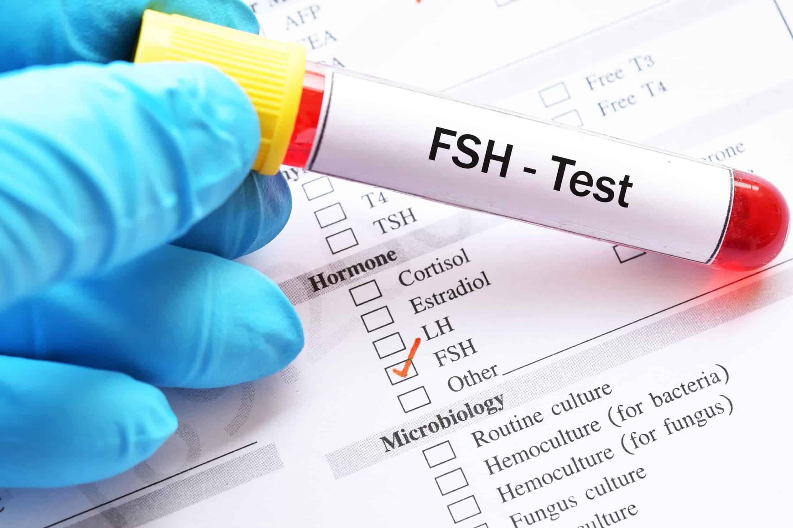 fsh test in hindi