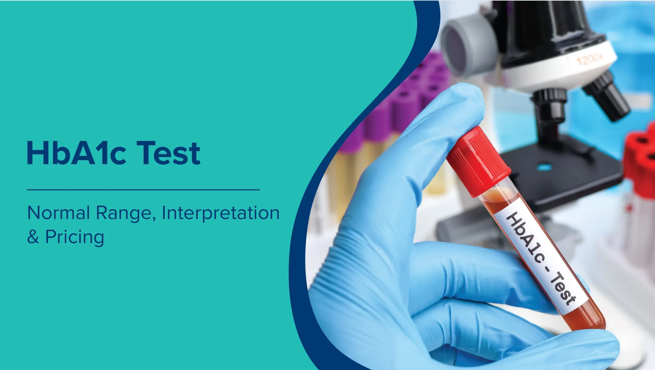 hb a1c test normal range e9ffd0b050