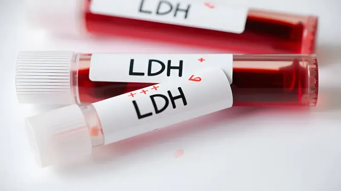 lactate dehydrogenase test overview and procedure