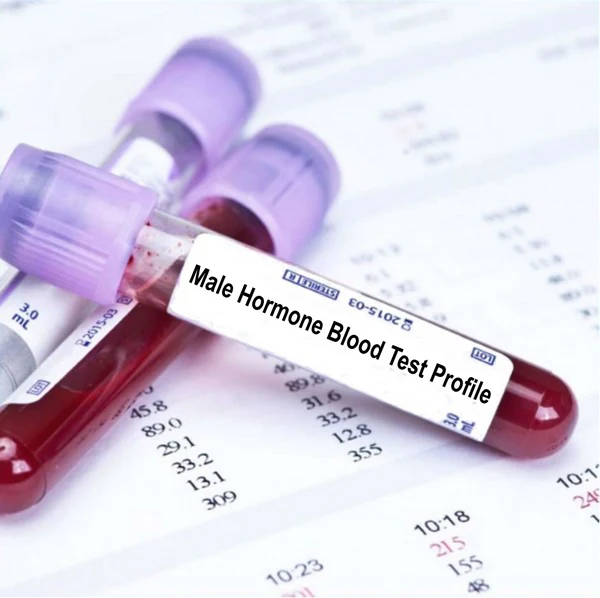 male hormone blood