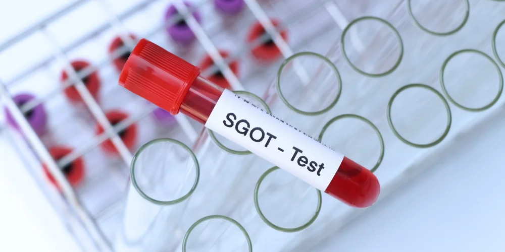 sgot test in mira bhayandar