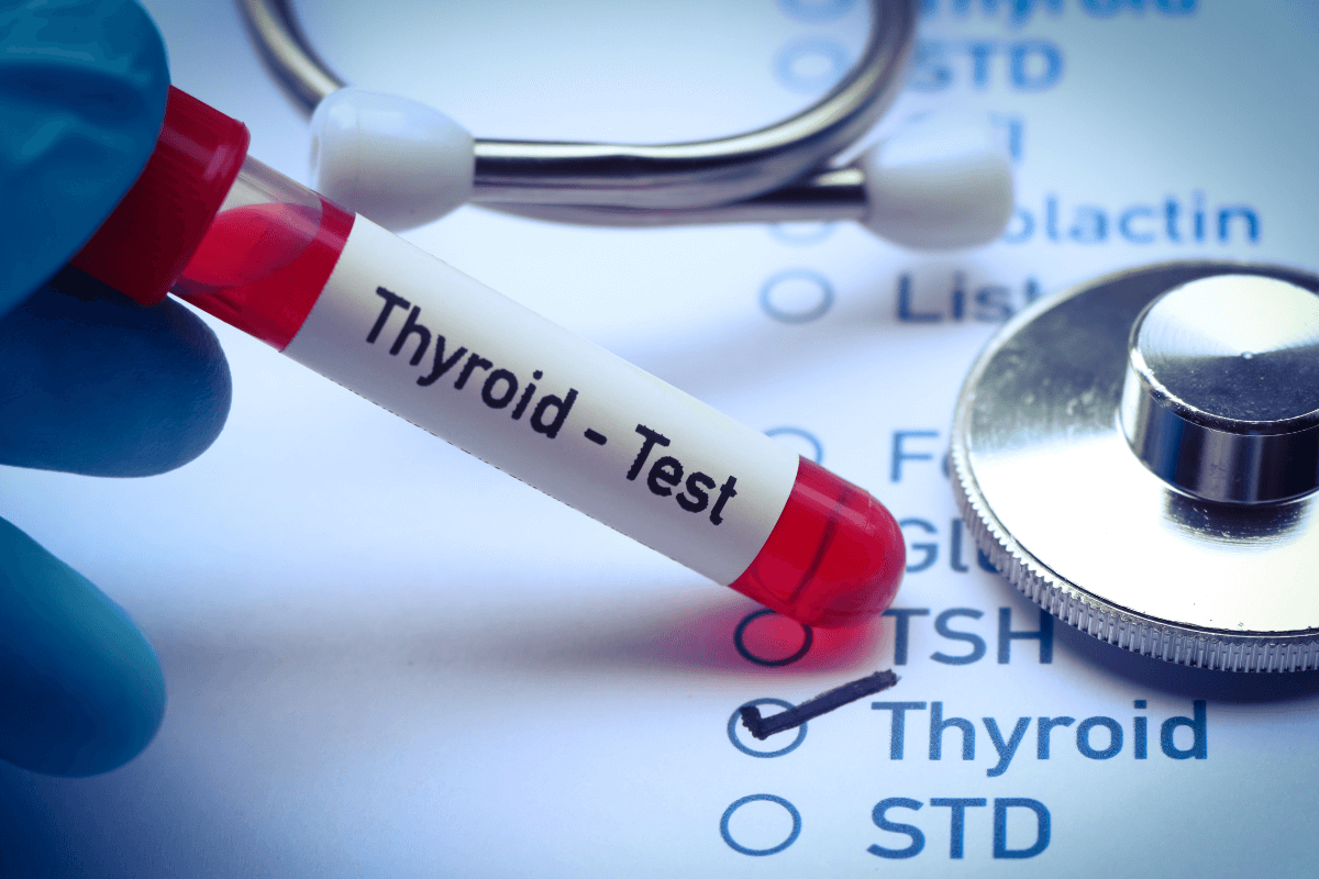 thyroid profile test in varanasi