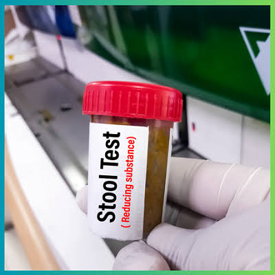 urine culture test finding the cause of uti 34ed6f01 2674 4304 b8d4 77b9523bd9a5