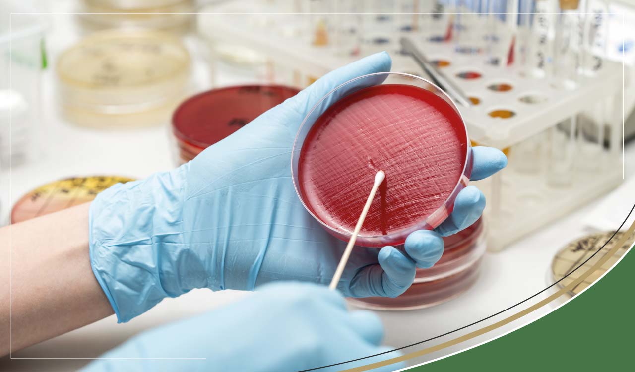 urine culture test finding the cause of uti 34ed6f01 2674 4304 b8d4 77b9523bd9a5