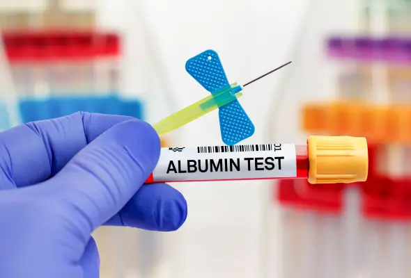albumin level