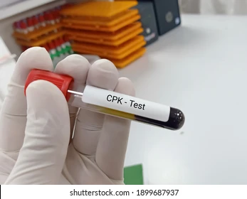 biochemist lab technologist holds blood 260nw 1899687937