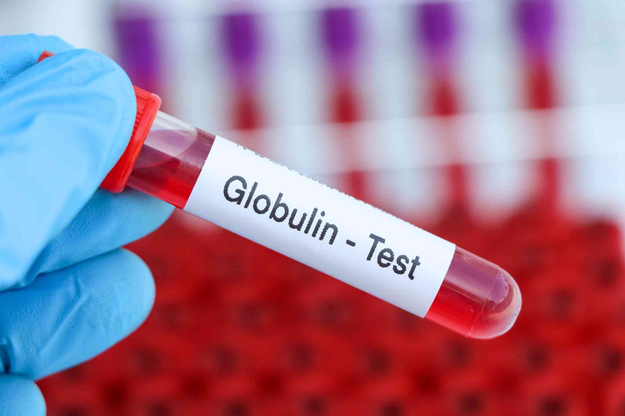 compressed globulin test