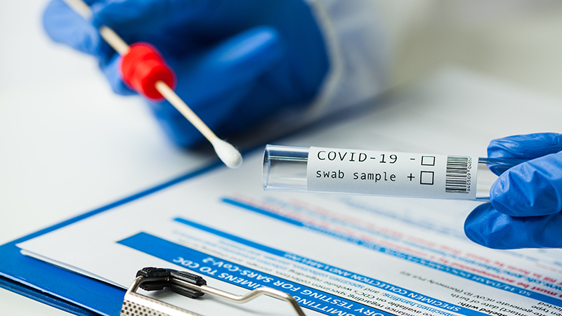 coronavirus pcr test