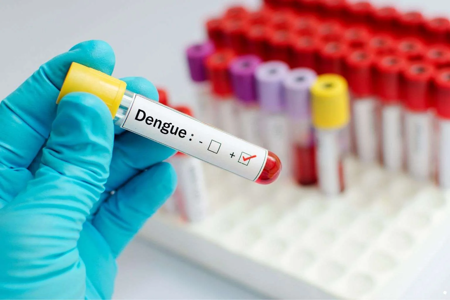 dengue test