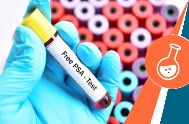 free psa test