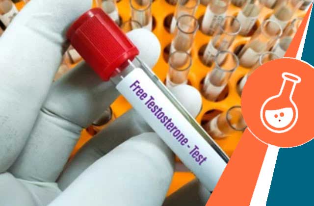 free testosterone test