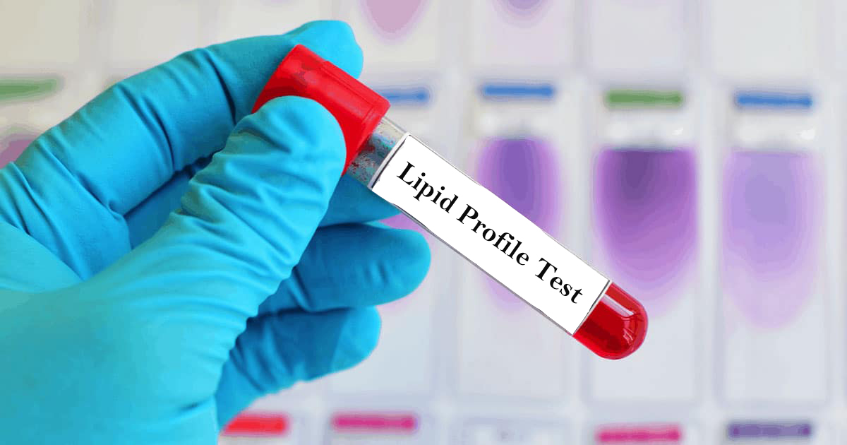 lipid test