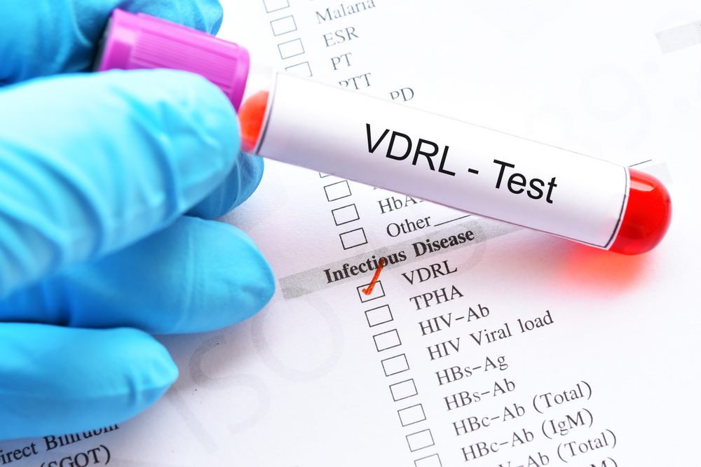 blood,sample,tube,with,laboratory,requisition,form,for,vdrl,test,
